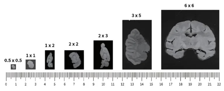 spatial-transcriptomics-varius-tissues-sizes-768x314.jpeg